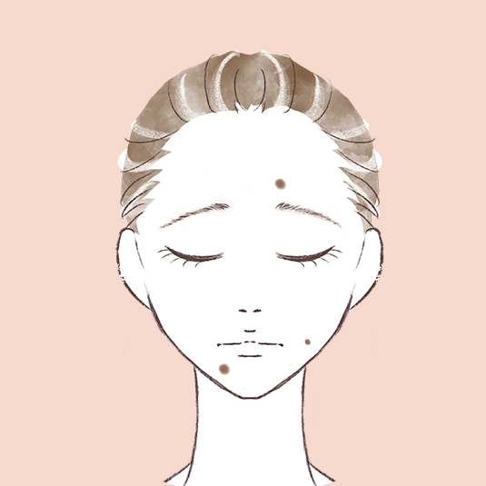 ほくろ